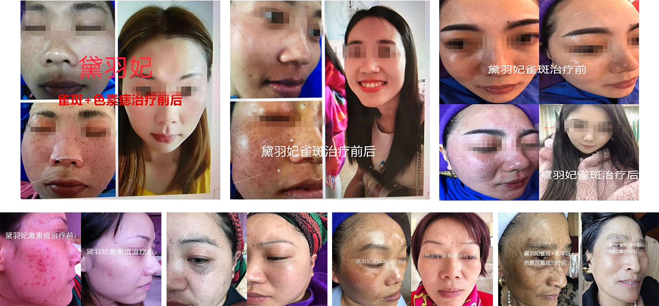 �������ί�ǰ��Ч�����ȈD